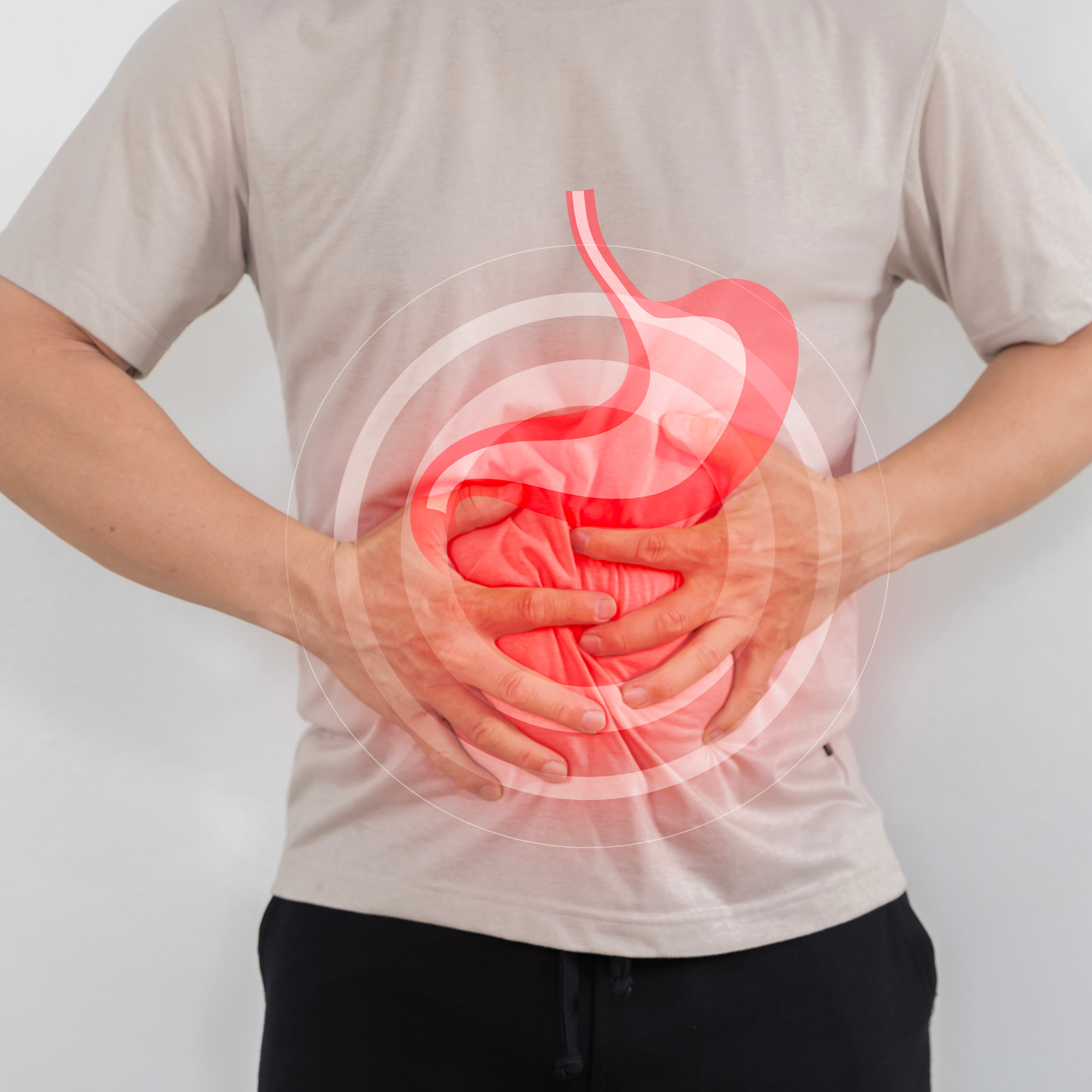 Irritable Bowel Syndrome