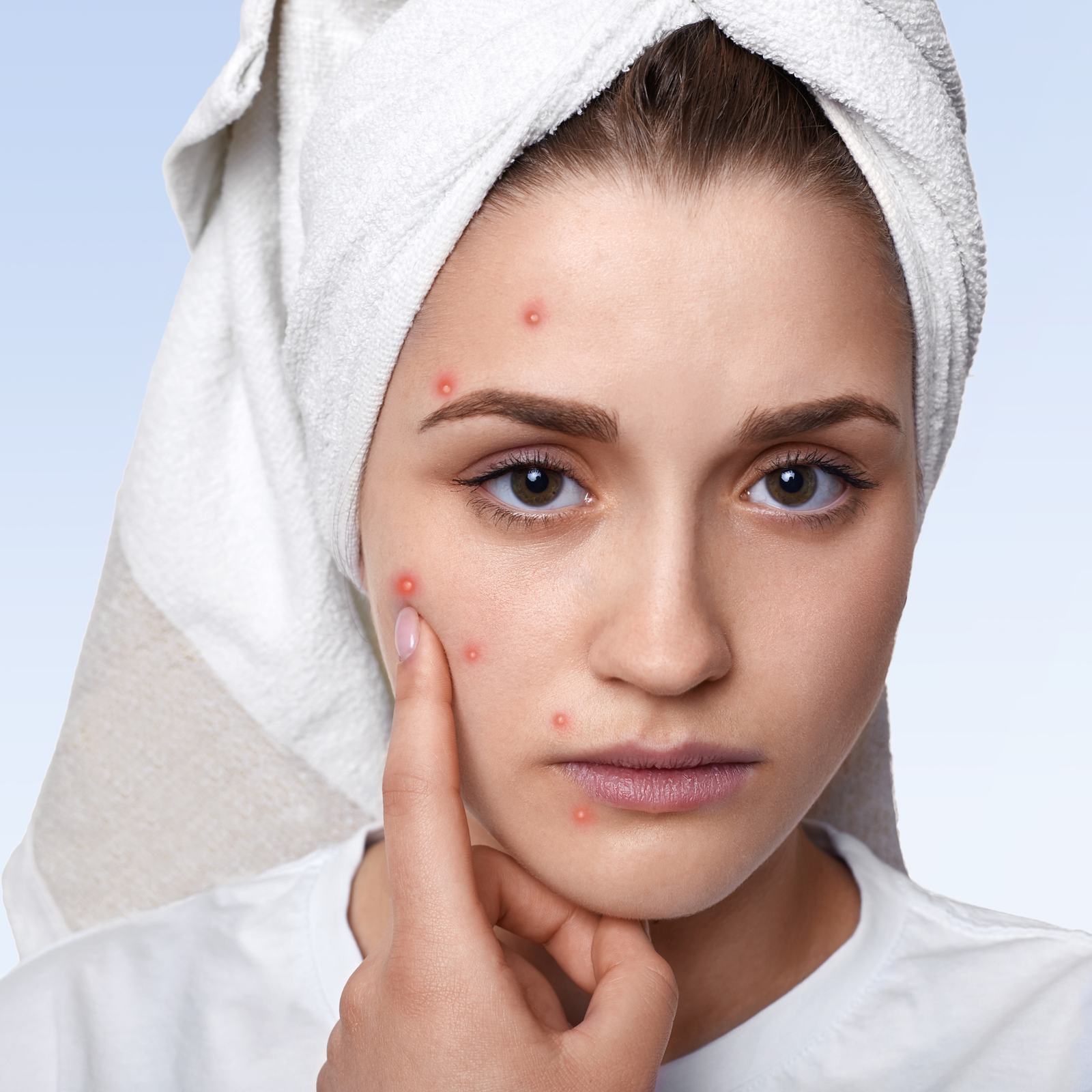 Skin Allergy